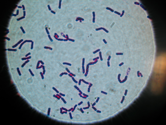 bacillus cereus gram stain